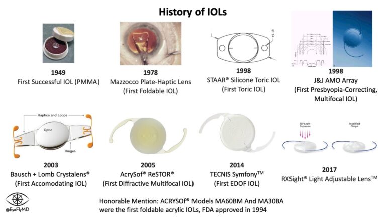Intra Ocular Lens treatment in Lucknow